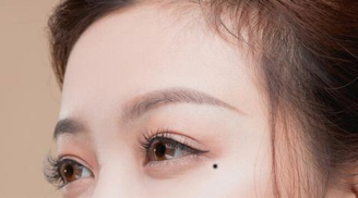Sở hữu 5 nốt ruồi này, kinh doanh cực thịnh, buôn đâu lời đó, dễ thu bạc tỷ
