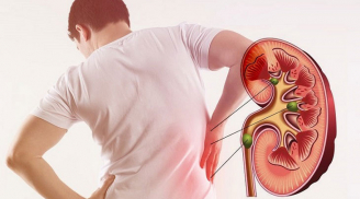 8 dấu hiệu cho thấy bạn đang bị suy thận mức độ nặng, có 1/8 cũng nên đi khám
