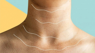 3 dấu hiệu 'lạ' ở cổ cảnh báo ung thư đã 'tấn công' Sh88bet đăng ký miễn phí, thử kiểm tra lại xem nhé!
