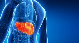 Thói quen sai lầm khiến người Việt phát hiện bệnh ung thư gan ở giai đoạn muốn, muốn chữa cũng khó