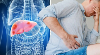 Ấn khẽ vào 4 vùng trên Sh88bet đăng ký miễn phí: Thấy bị đau là lời cảnh báo bệnh gan đang trở nặng