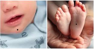Trẻ may mắn có 1 trong 7 nốt ruồi này: Tương lai sáng chói, lớn lên ắt làm quan, cả họ được nhờ