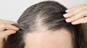 Nhổ tóc bạc 'tưởng không hại nhưng hại không tưởng': BS cảnh báo 5 nguy cơ có thể gặp phải, ai cũng cần biết