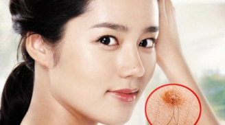 Nhìn tướng đoán tài lộc: 4 vị trí mọc lông báo hiệu của cải ùn ùn kéo đến, chớ có nhổ bỏ