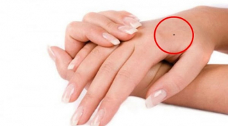 3 nốt ruồi 'quý hơn vàng mười', ai sở hữu thì lúc trẻ kiếm tiền đầy túi, về già an nhàn hưởng phúc