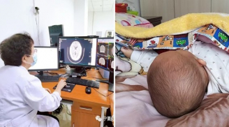 Trẻ ngủ gối và không ngủ gối có 3 điểm khác biệt khi lớn: Không chỉ IQ, cột sống cũng biến đổi bất ngờ