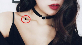 9 nốt ruồi trên mặt quý hơn vàng mười, sở hữu 1/9 cũng đủ may mắn, nhiều người chê xấu lại xóa đi