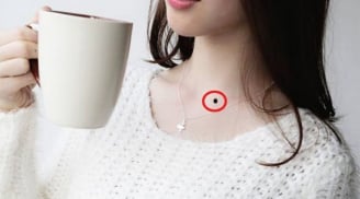 5 nốt ruồi đắc tài đắc lộc, ai sở hữu thì vạn sự hanh thông, tiền tiêu không lo nghĩ