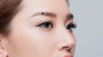 5 nốt ruồi vượng phúc vượng lộc, ai sở hữu 3 đời giàu 'đổ tường nứt vách'