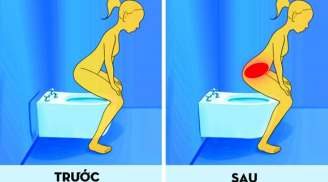 Tư thế đi vệ sinh sai be bét khiến chị em dễ bị nhiễm trùng đường tiết niệu