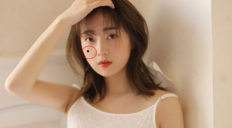 Sở hữu 5 nốt ruồi này, đàn ông làm ra vàng, phụ nữ hái ra bạc, cả đời giàu sang, sung túc