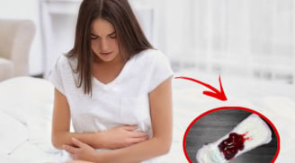 Phụ nữ đến kì kinh nguyệt hay bị vón cục có sao không?