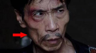 Ông cha ta bảo: 'Người hai má hõm không có thịt, đừng dại mà kết thân”, vì sao?