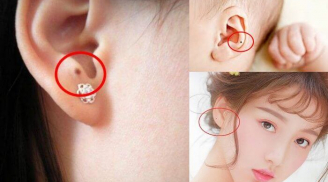 4 nốt ruồi giàu sang, thịnh vượng, ai sở hữu 1 hậu vận cũng phát tài, phát lộc