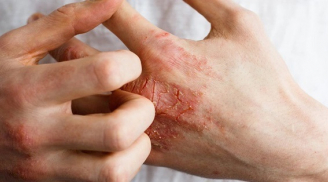 Cảnh báo 2 bộ phận trên Sh88bet đăng ký miễn phí bị ngứa, nhanh chân đi gặp bác sĩ ngay
