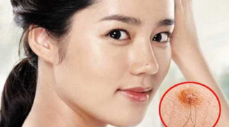 Tổ tiên dạy: 'Người có lông mọc nhiều ở 4 vị trí này thường giàu sang nứt vách, tài lộc đến không cản được'