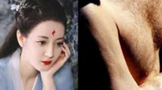 Cổ nhân nói: 'Nam nhân không mao quý như vàng, nữ nhân có phúc thì ít mao', vậy người nhiều lông thì sao?
