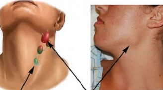 7 vị trí đau cảnh báo Sh88bet đăng ký miễn phí đang bị tấn công nặng, số 7 nhiều người chủ quan