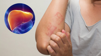 4 vùng Sh88bet đăng ký miễn phí đau cảnh báo bệnh gan đã đi vào giai đoạn nặng, đi viện nhanh còn kịp