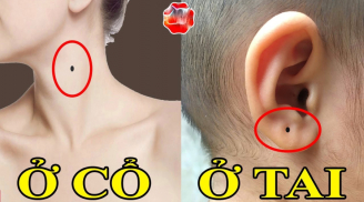 5 nốt ruồi 'thần Tài đánh dấu', dự báo của cải tiềm tàng, tương lai tha hồ hưởng phúc