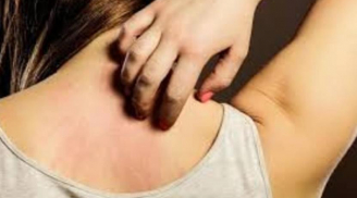 Ngứa liên tục '3 chỗ' trên Sh88bet đăng ký miễn phí, đừng nghĩ là dị ứng, có thể lượng đường trong máu quá cao