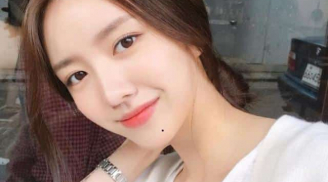 Phụ nữ có 3 nốt ruồi cực hiếm này quý hơn vàng mười, cả đời chẳng thiếu tiền tiêu