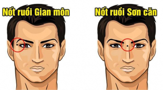 5 nốt ruồi hãm Tài, phá tướng: Có 1 cái thôi cũng khó mà giàu