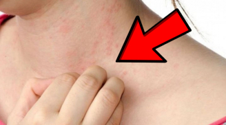 Ngứa 4 chỗ này, đừng nghĩ là dị ứng, gặp bác sĩ ngay kẻo mắc K lúc nào không biết