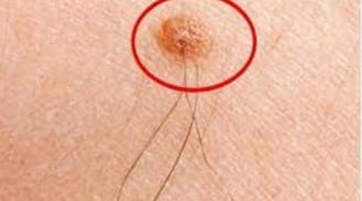 Lông vị trí này càng dài thì càng sống thọ, đặc biệt vị trí số 3 nhiều người 'e ngại'