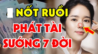 5 nốt ruồi cực phẩm tượng trưng cho Tài Lộc Danh: Ai có 1/3 cũng tha hồ mà hưởng
