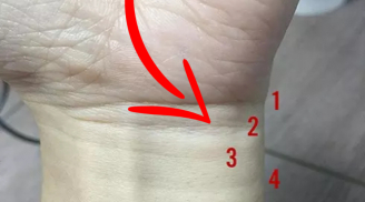 Nhìn 3 giây vào đường ngấn cổ tay, biết ngay ai có số giàu có hay nghèo hèn
