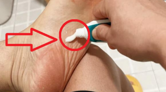 Đi ngủ buổi tối cứ bôi kem đánh răng vào lòng bàn chân, tác dụng tốt cho cả nam và nữ