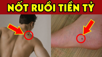 Trên người ai có 5 nốt ruồi 'đẻ ra tiền' này, càng già càng an nhàn hưởng phúc