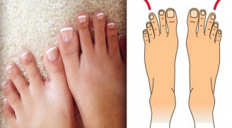 Các cụ nói: 'Ngón chân thứ hai dài hơn ngón cái, lớn lên không hiếu thuận', thực hư thế nào?