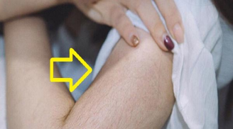 'Phụ nữ rậm lông, đàn ông được nhờ', có thật như vậy không?