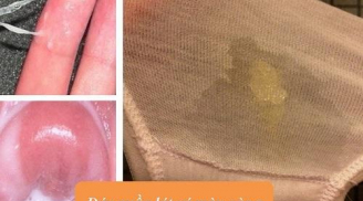 Đáy quần lót có màu vàng đục: Chị em phải làm ngay việc này kẻo hối hận