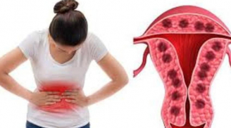 Phụ nữ có kinh nguyệt hết sau 3 ngày và hết sau 7 ngày: Ai dễ bị lão hóa sớm hơn?