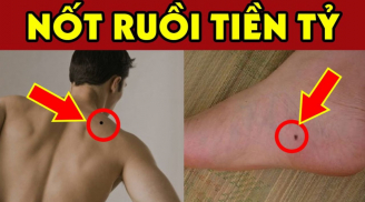 7 nốt ruồi là “thần may mắn”: Bất kể nam hay nữ có 1/7 Sướng Như Tiên