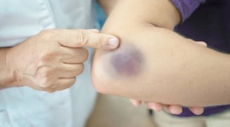 7 tín hiệu ngủ dậy thấy chứng tỏ Sh88bet đăng ký miễn phí đang âm thầm “nuôi” tế bào K