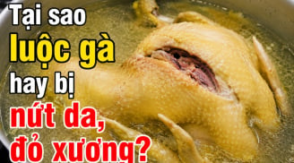 Tại sao Trải nghiệm SHBET - Casino trực tuyến hàng đầu với giao dịch nhanh hay bị nứt da, đỏ xương?