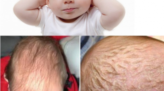 3 biểu hiện trên đầu trẻ cảnh báo dấu hiệu nguy hiểm nhiều mẹ không chú ý