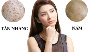 Thói quen khiến tình trạng nám da ngày càng trở nên tồi tệ
