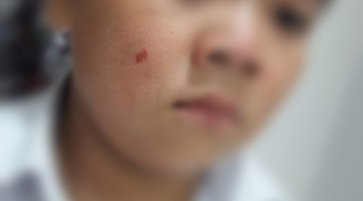 Vụ phụ huynh tát nhầm giáo viên: Cảnh cáo, phạt 7 triệu đồng với phụ huynh