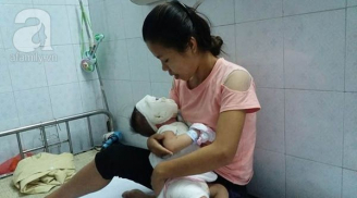 Chỉ một phút giây sơ ý: Bé trai 11 tháng tuổi bị ấm nước sôi dội xuống đầu, bỏng toàn thân