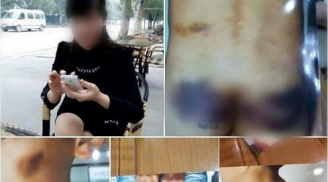 Vụ bé trai bị mẹ kế bỏ đói, dùng chày đánh: Đại diện Trưởng phòng tham mưu Công an nói gì?