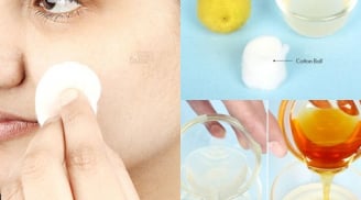 Bí quyết đánh bay thâm sẹo mụn siêu hiệu quả 100 người làm thì 99 người thành công