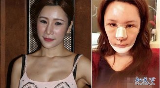 Đòi xinh đẹp như Angelababy, mẫu nữ Hồng Kông trả giá đắt