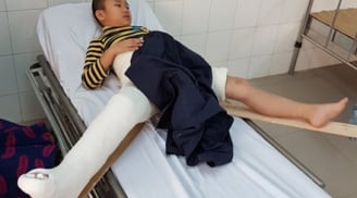 Vụ học sinh bị đâm gãy chân trong trường: Những điều bất minh trong bản báo cáo của cô Hiệu trưởng
