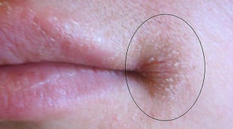 Nhìn thấy chỗ này mà có biểu hiện dưới đây hãy đi khám ngay lập tức kẻo hối thì muộn