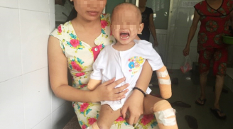 Điểm tin mới 3/8: Xót xa bé gái 2 tuổi bị đoạn tứ chi vì viêm não mô cầu